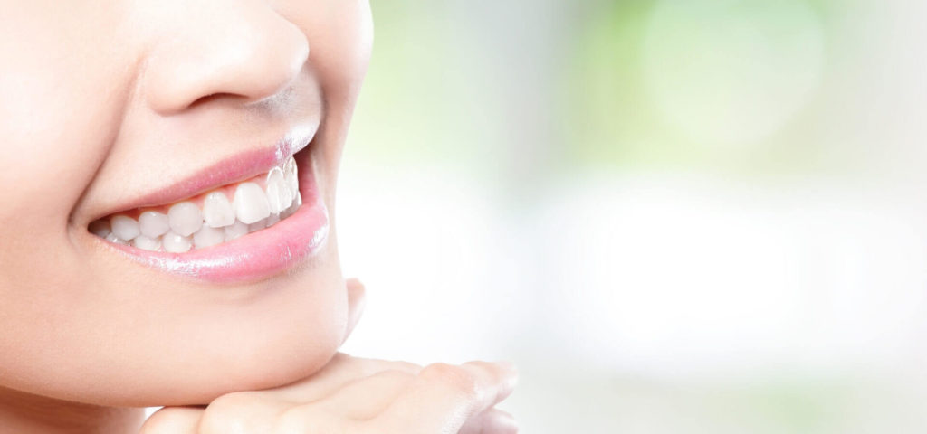 Teeth Whitening at Private Dentists in London