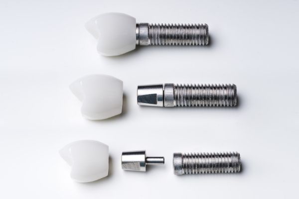 What-are-dental-implants