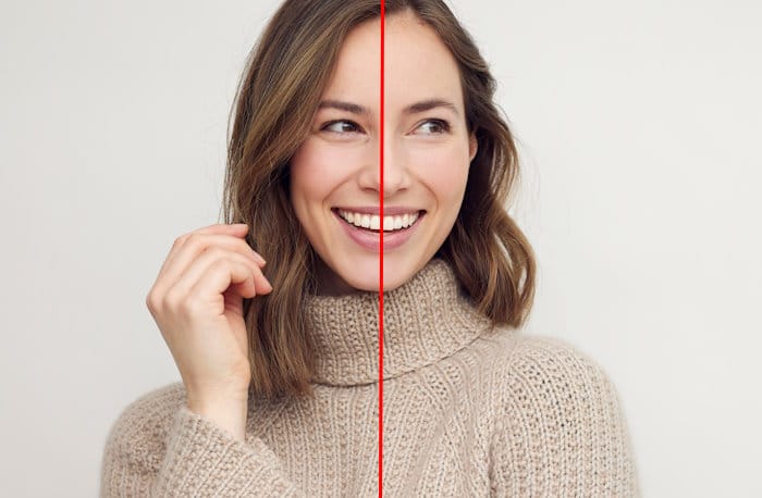 Smile Makeover v2