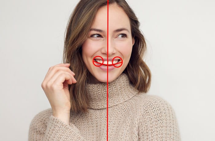 Smile Makeover v2