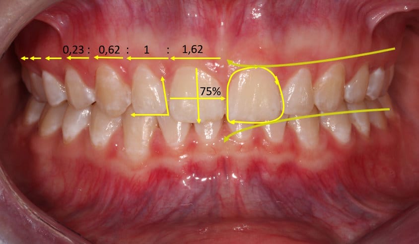 Smile Makeover v2