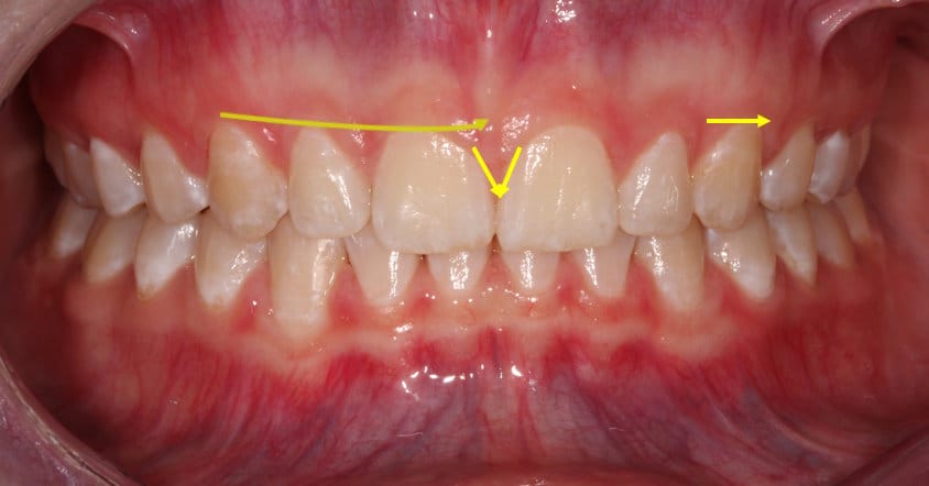 Smile Makeover v2