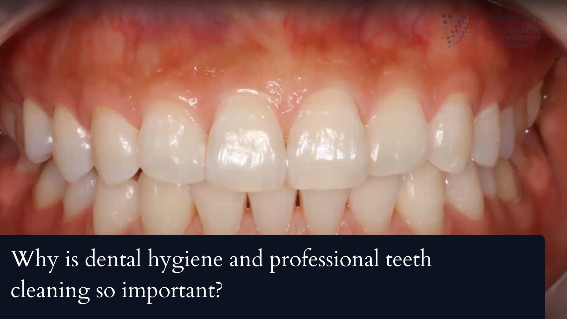 Why is dental hygiene & professional teeth cleaning so important?