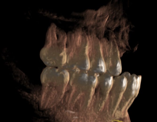 2.1 Medium sized bone 3