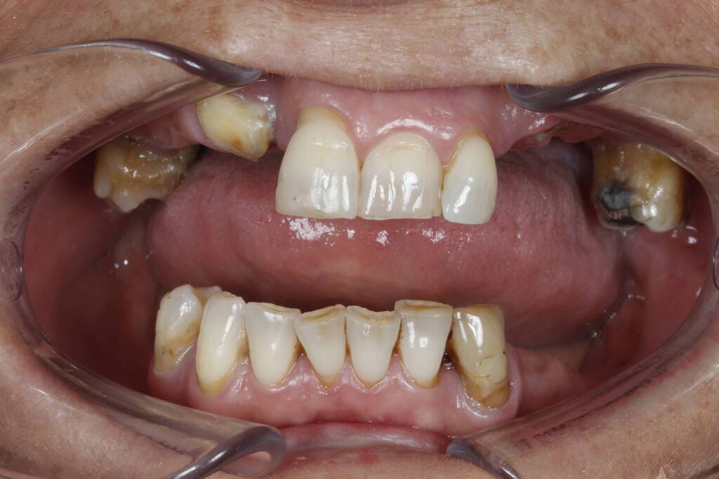 02-initial-intra-oral