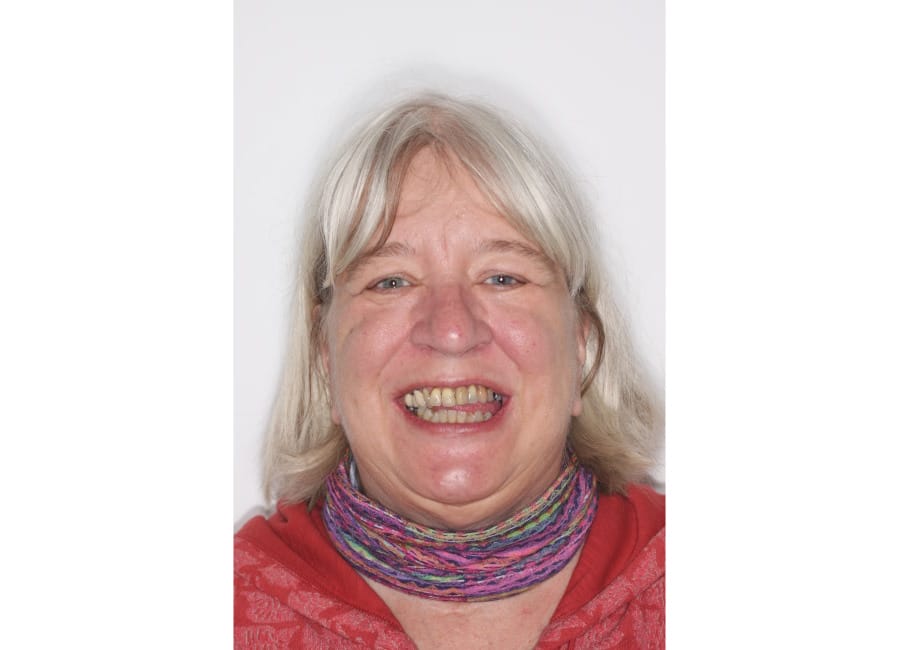 1 Full Face before start