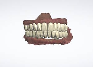 8 New Set up of teeth