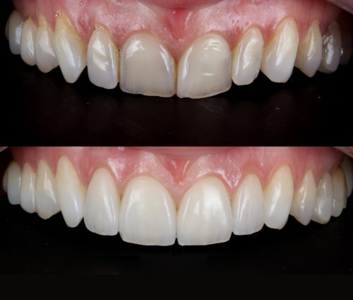 05 initial cont 05 initial cont