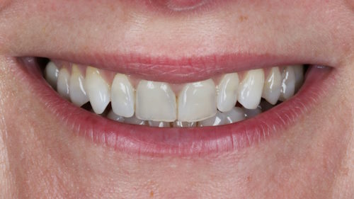 06 initial smile 06 initial smile