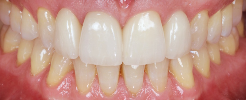 33 final IO 33 final IO