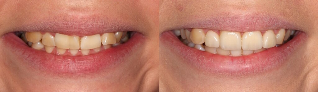 Before and after: Cosmetic Transformation