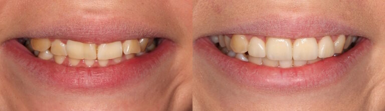 Before and after: Cosmetic Transformation