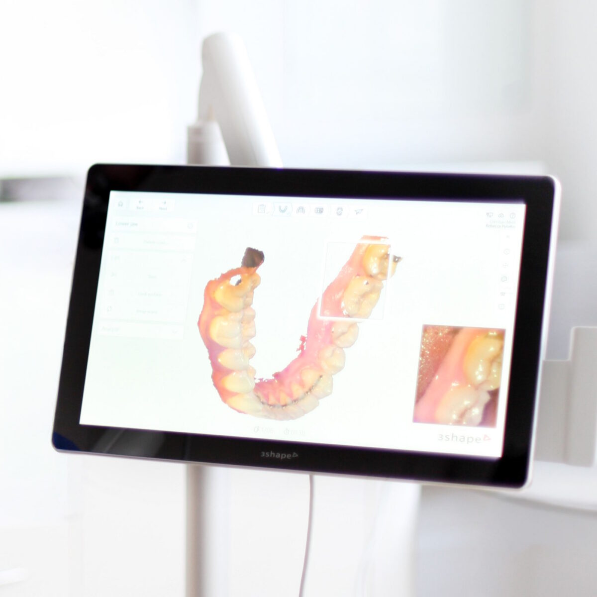 Digital Scanning Technology At The Clinic